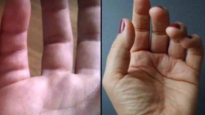research few people have extra creases on their little fingers 78a788a