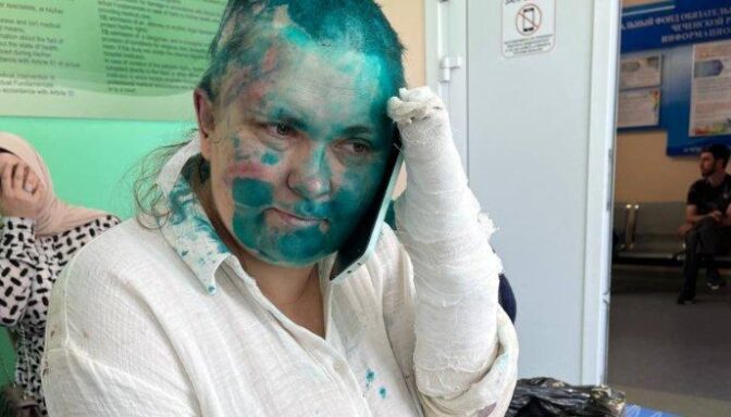 Russian Journalist Yelena Milashina Was Tortured, Shaved And Covered In Green Paint In Chechnya
