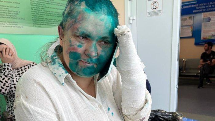 russian journalist yelena milashina was tortured shaved and covered in green paint in chechnya b0b2642
