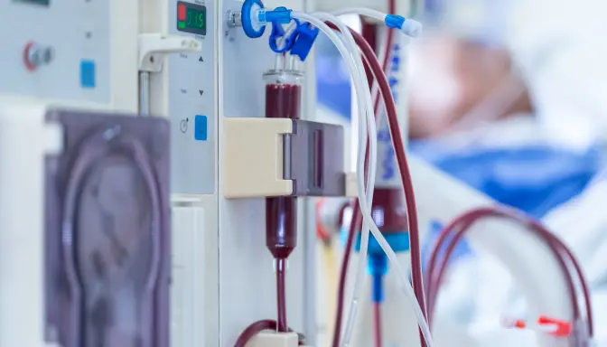 Efek Samping Cuci Darah, Gejala yang Harus Diwaspadai Pasien