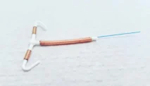 Waspadai Efek Samping KB Spiral (IUD), Ini Faktanya!
